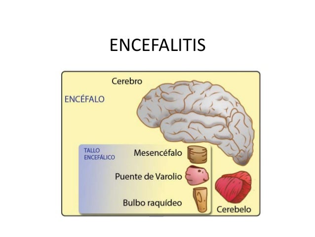 ENCEFALITIS INFANTIL encefalitis infantil:
