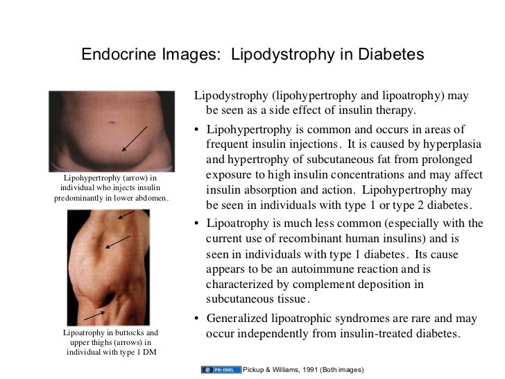 Images of Endocrine Disorders