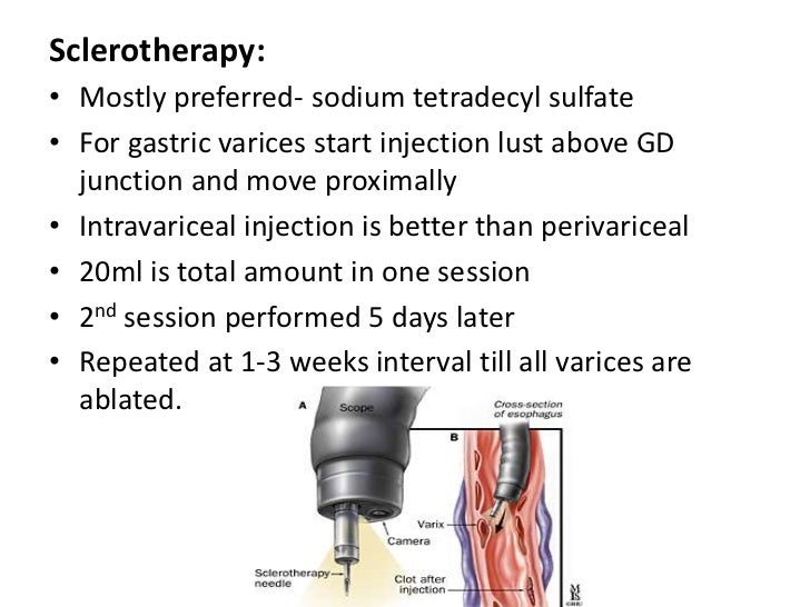 THERAPEUTIC ENDOSCOPY IN GI SURGERY