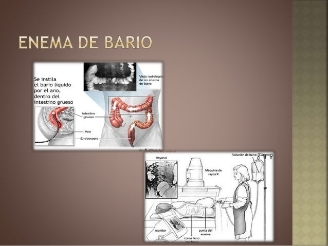 Como Preparar Enema De Cafe Como Preparar Enema De Cafe