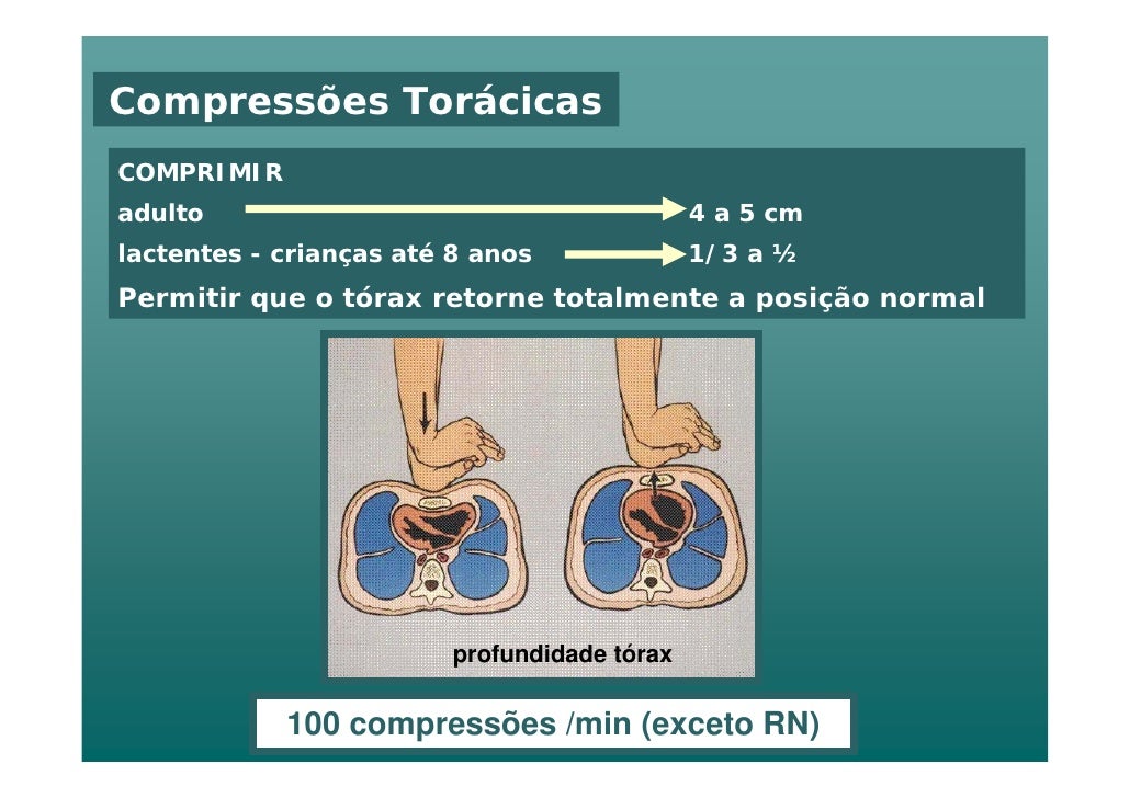 Quantas Compressoes Por Minuto - RETOEDU