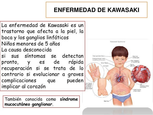 Emolium para la psoriasis