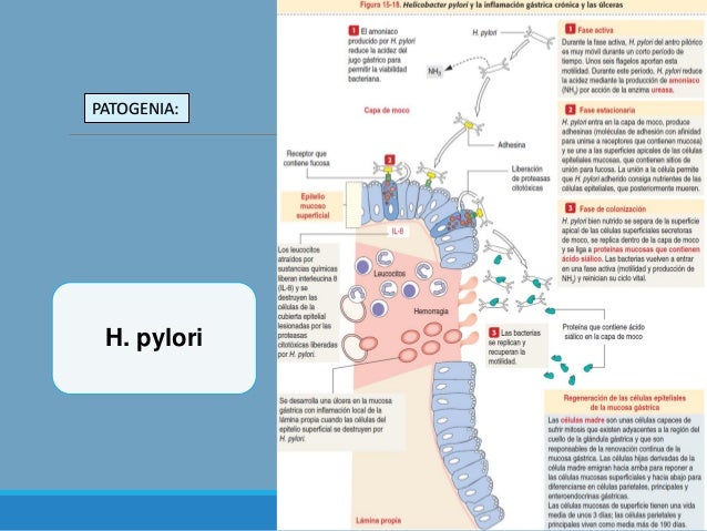helicobacter pylori im darm