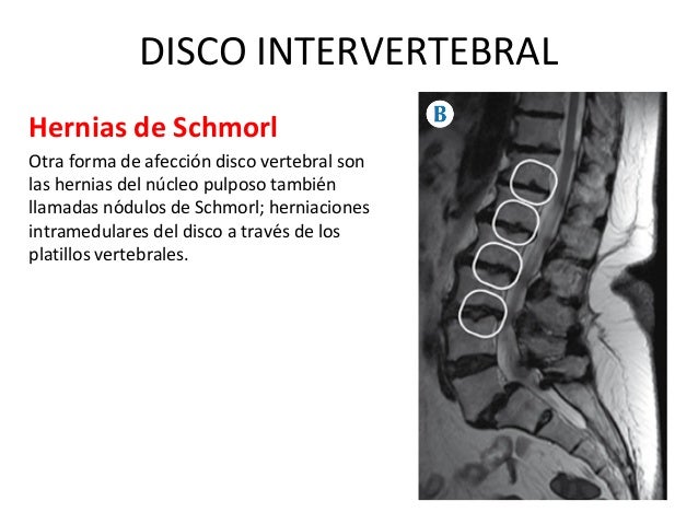 Duele en el lado derecho inferior de la espalda
