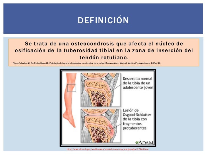 Los grupos sheynogo de la osteocondrosis