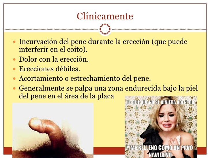 Los complejos a propósito de un pequeño miembro