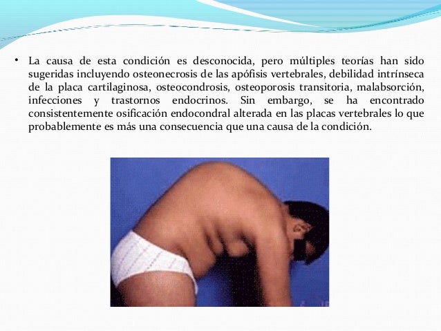 El indicio del embarazo el dolor vivo en los riñones