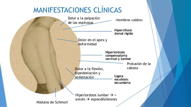 Duele los riñones por la mañana la causa