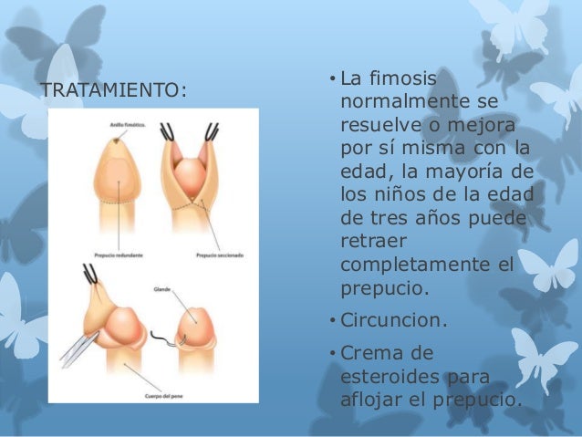 Como aumentar el miembro en la longitud y el diámetro