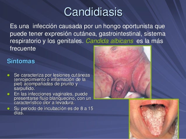 Como sanar el hongo de las uñas en los pies por los medios públicos por el cloro