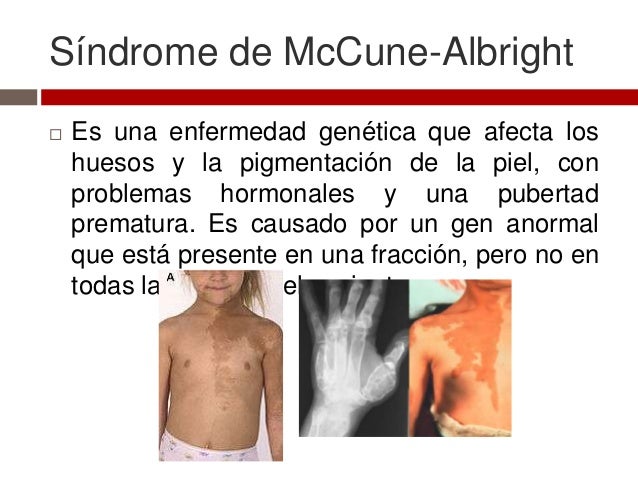 La muchacha con las pecas y los cabellos rosados