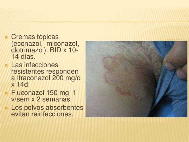 El champú a la psoriasis de la parte pilosa de la cabeza el precio