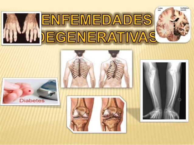 Enfermedades Degenerativas Enfermedades Degenerativas