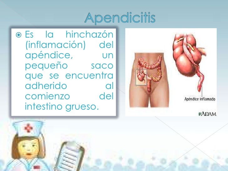 El tratamiento de la osteocondrosis aguda medicamentoso