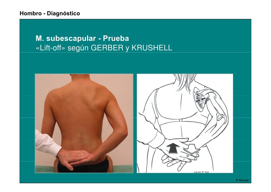 Enfermedades del hombro y pruebas diagnósticas wander