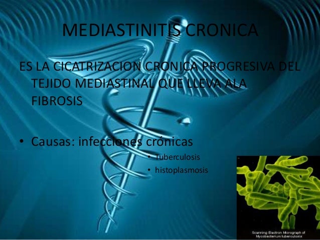 Nesteroidnye los analgésicos a la osteocondrosis de pecho