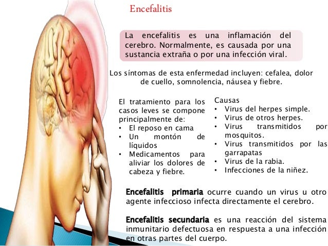 La osteocondrosis del departamento lumbosacro de la columna vertebral el tratamiento que este tal