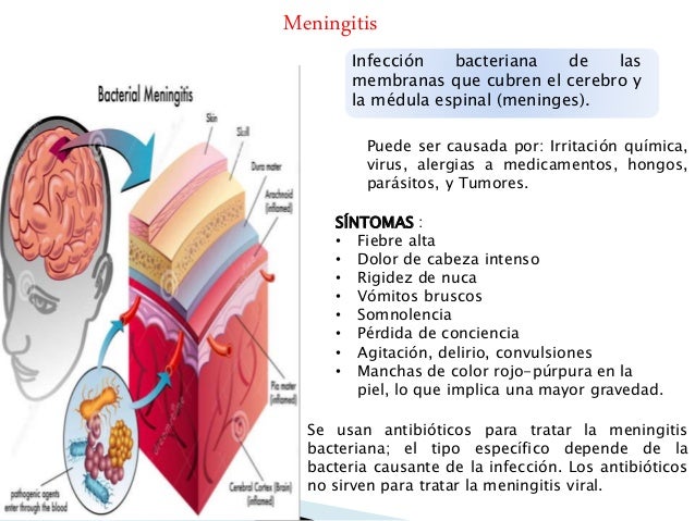 Enfermedades del sistema nervioso: Central Autonomo y Enfermedades del sistema nervioso: Central Autonomo y
