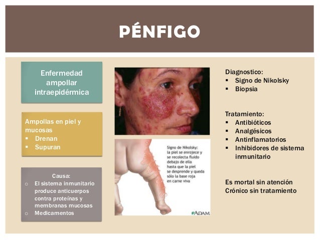 A que médico dirigirse el grano sobre la persona