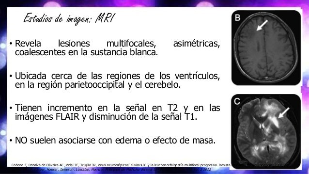 Adelgazar el programa alemán