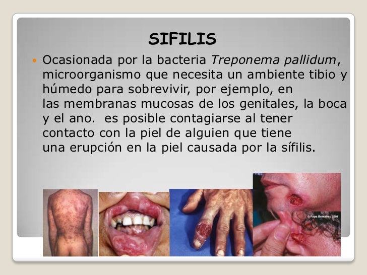 Como la psoriasis funciona a las heridas