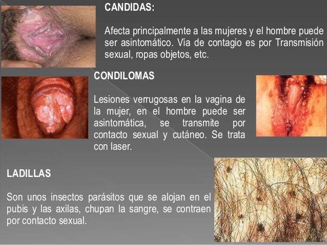 Los helmintos a los niños el mensaje
