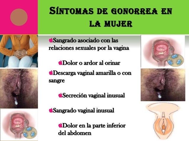 Duele los riñones al cáncer del recto