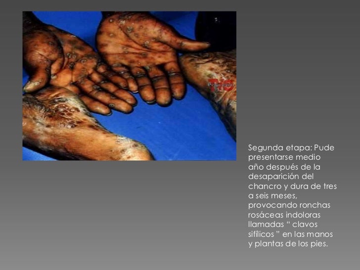 Los ejercicios el masaje para el aumento del pene