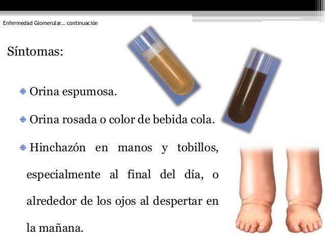 Duele la espalda quiebra los pies y la temperatura