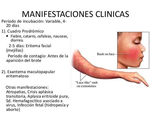 Nasal sinus endoscopy surgical with sphenoidotomy bacterial sinus contamination symptoms