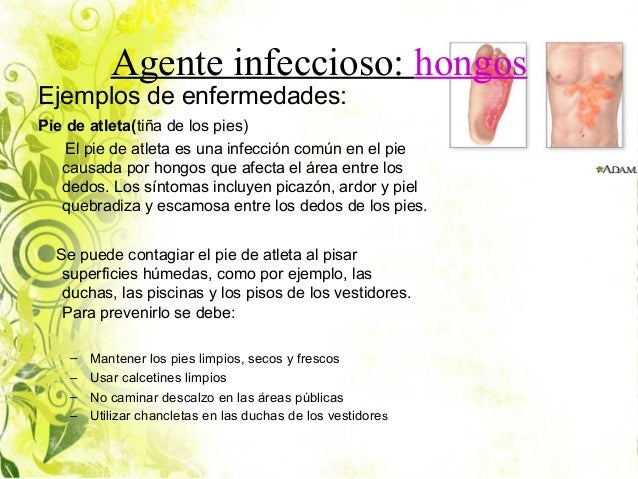 El hongo de las uñas el tratamiento en las manos los preparados