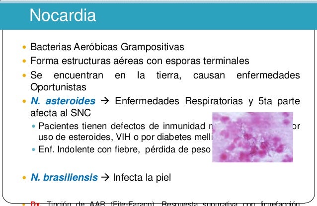 De duele la espalda