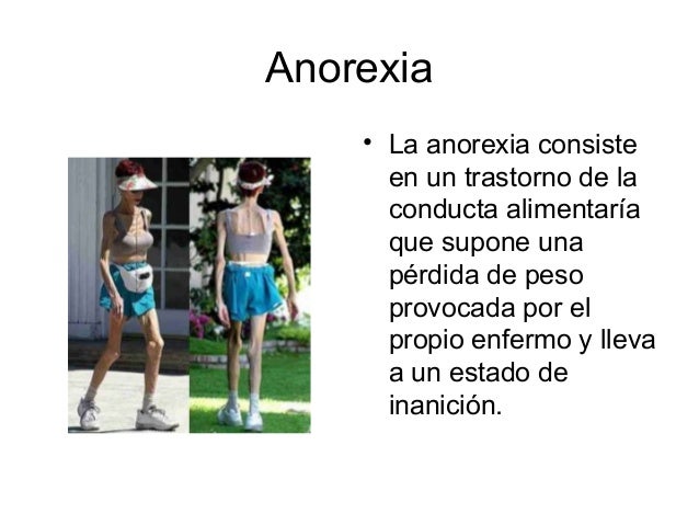 Otra imagen como hago para adelgazar rapido sin hacer dieta objetivo como hago para adelgazar rapido sin hacer dieta
