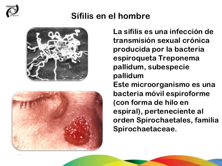 Sintomas De Fiebre Related Keywords - Sintomas De Fiebre Sintomas De Fiebre Related Keywords - Sintomas De Fiebre