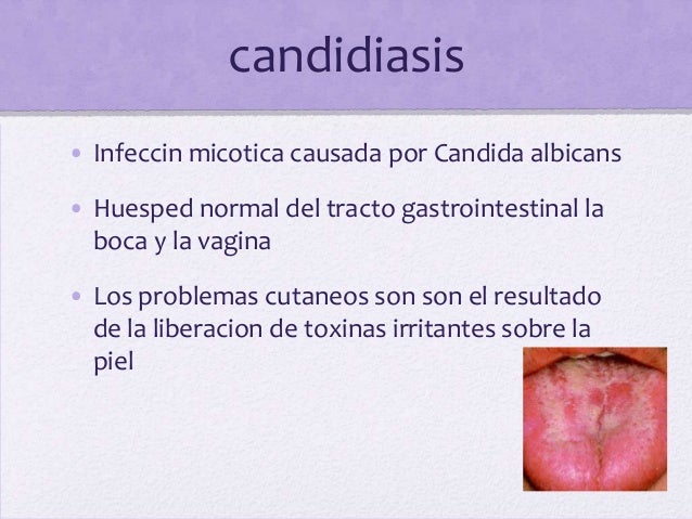 Como se librará de la psoriasis en 5 días