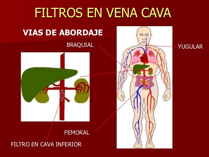 El centro flebologii el tratamiento y la profiláctica