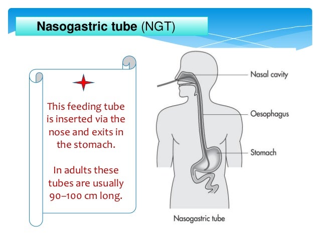 can gabapentin be given via peg tube