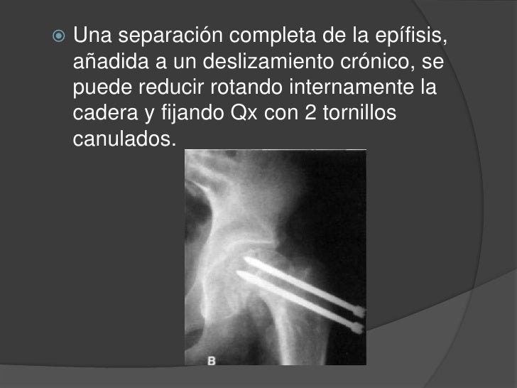Un más pequeño pene el mundo