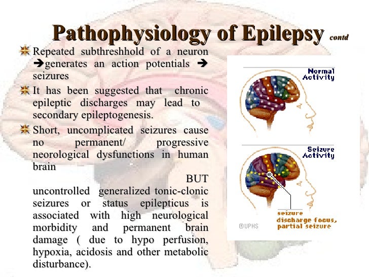 Epilepsy an overview