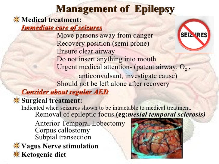 Epilepsy an overview