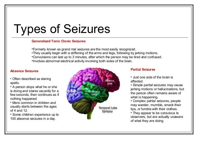 Absence Seizure Petit Mal Seizure Healthline