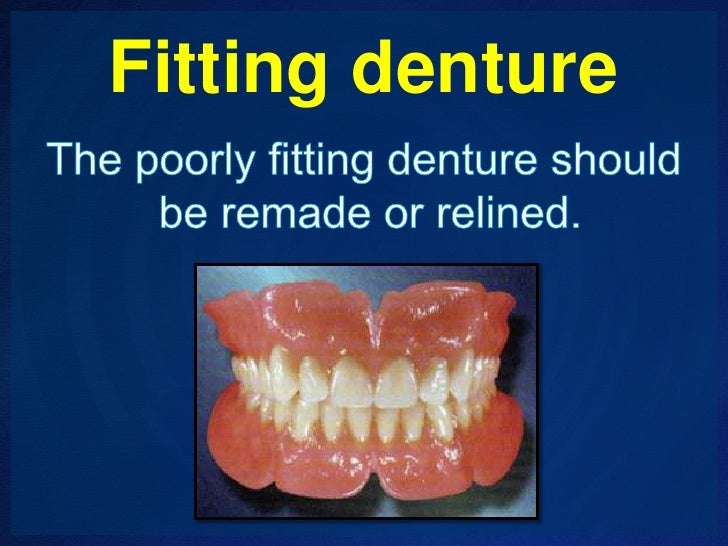 Management of Epulis fissuratum