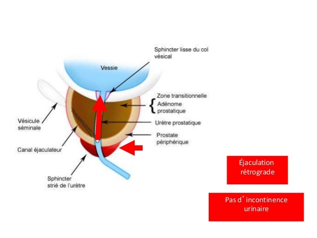 Clindamycin length of treatment pustulosis