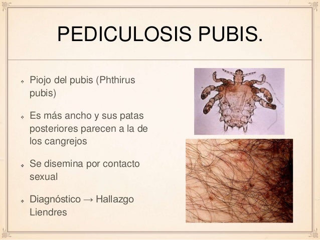 Hoofdluis / Pediculosis capitis - Huidarts.com