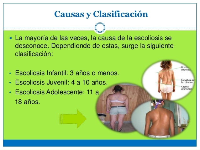 Atopichesky la dermatitis donde ser curado