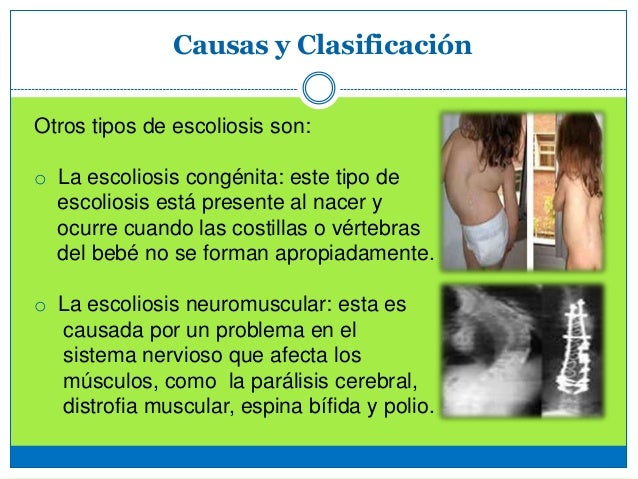 No específico spondilodistsit del departamento de pecho de la columna vertebral