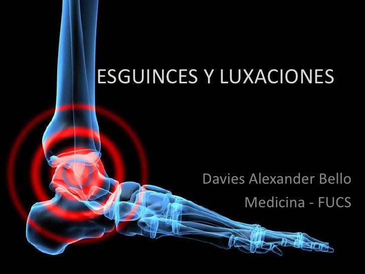 Esguinces y luxaciones