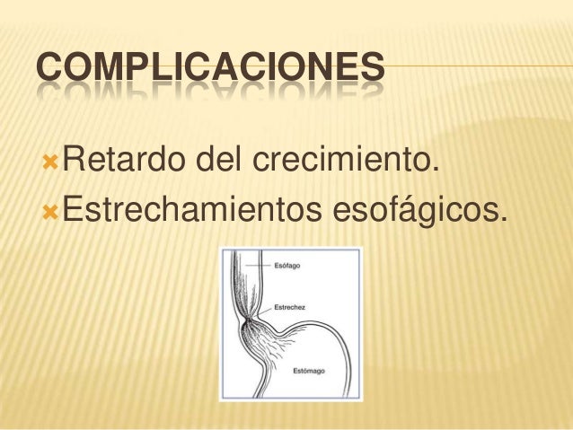 Que pastillas al alcoholismo sin médico