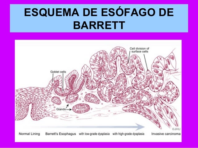 Darsonval y la red venosa
