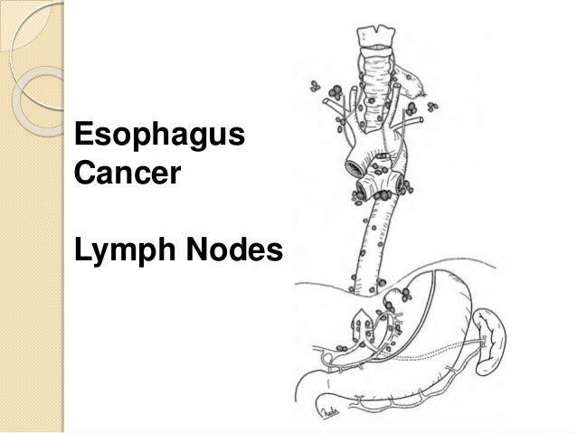 what is cin in cervical most cancers cervical cancer level four remission
